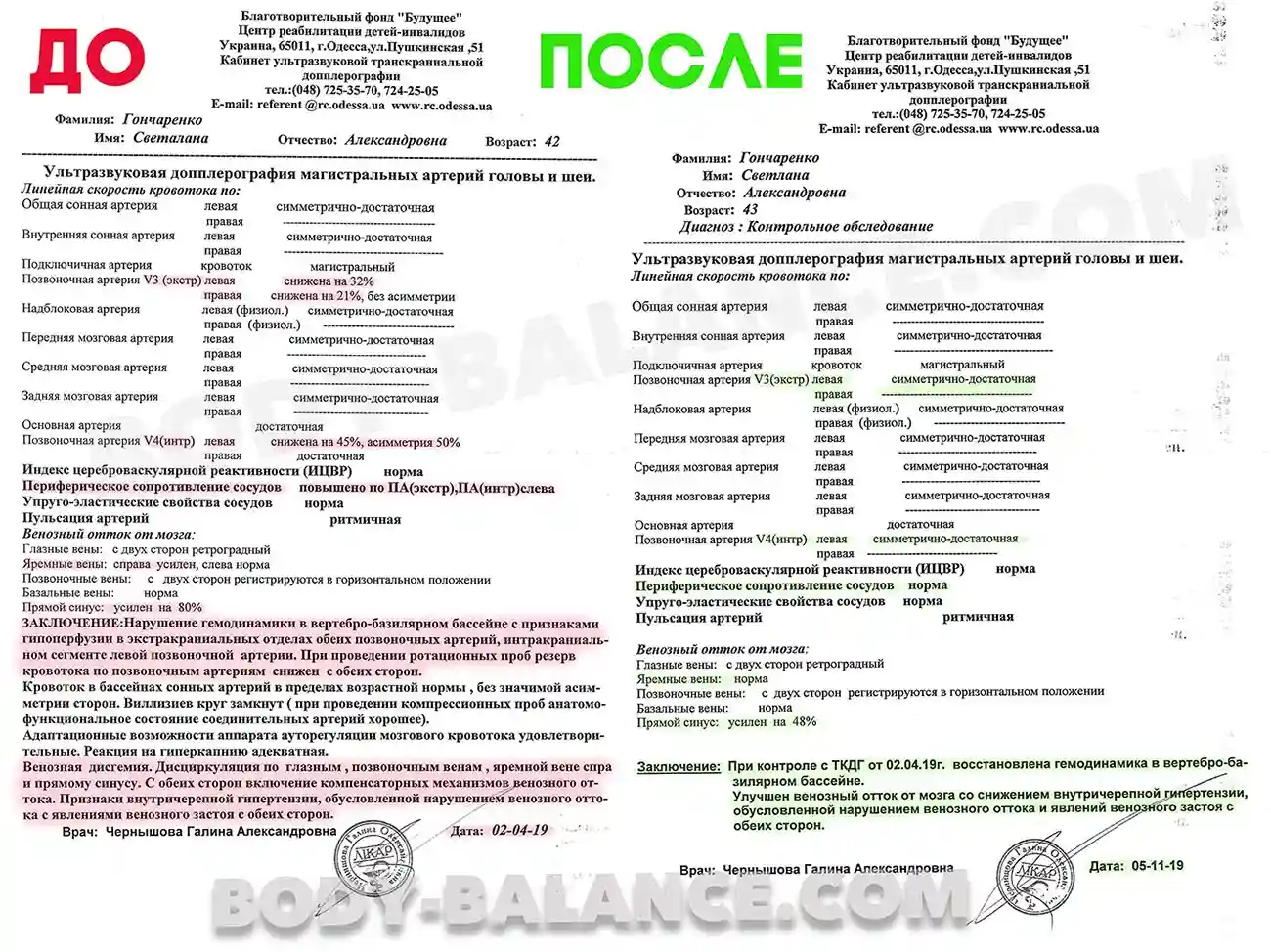 Результат УЗД сосудов головы и шеи