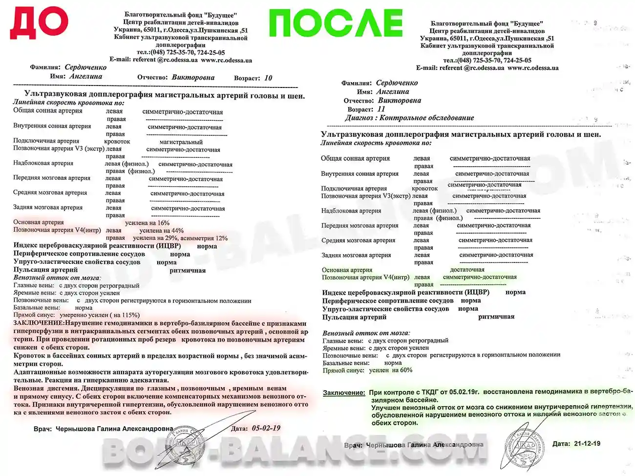 Результат УЗД сосудов головы и шеи