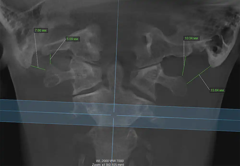Обследование шеи с помощью КТ. Метод Body Balance Clinic