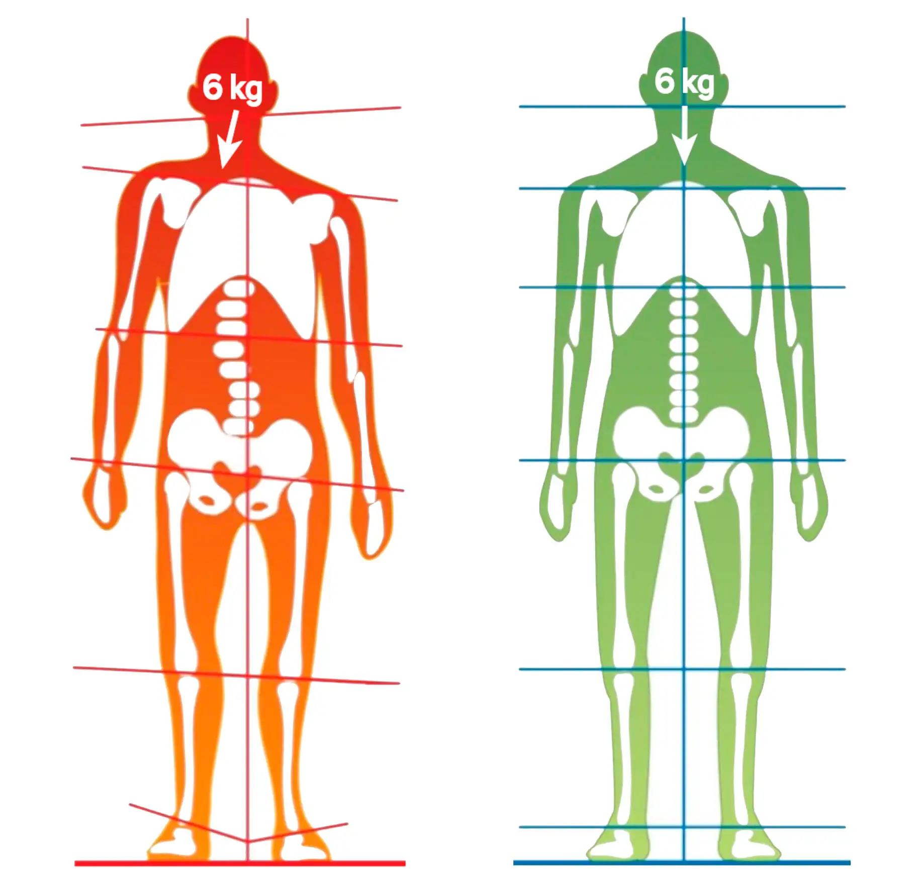 Can osteopathy or manual therapy restore the function of the cervical spine?