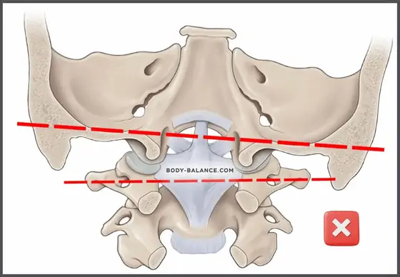 Importance of head joints function